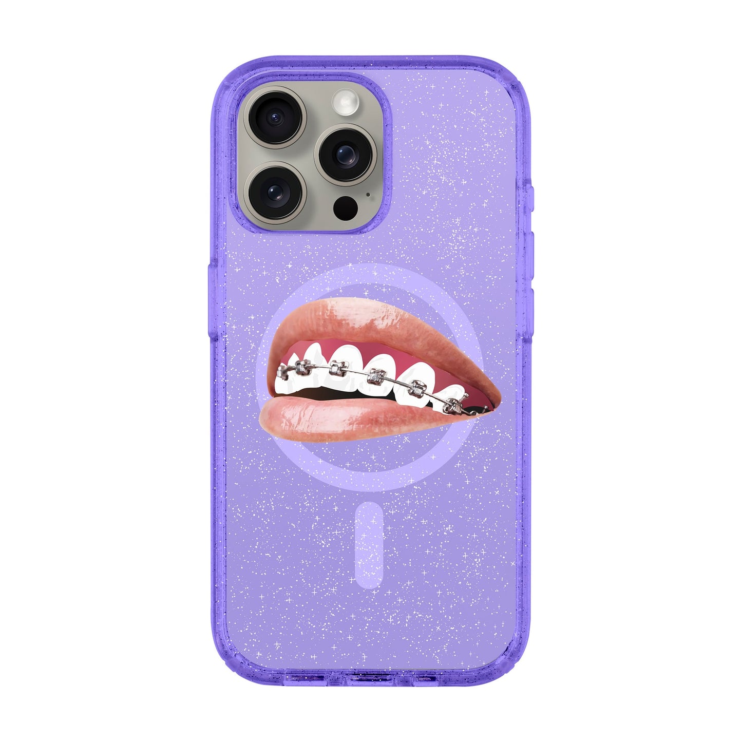 ORTHODONTIST-iPhone 15 Pro Max Shiny Kılıf MagSafe Özellikli