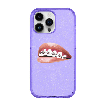 ORTHODONTIST-iPhone 14 Pro Max Shiny Kılıf MagSafe Özellikli