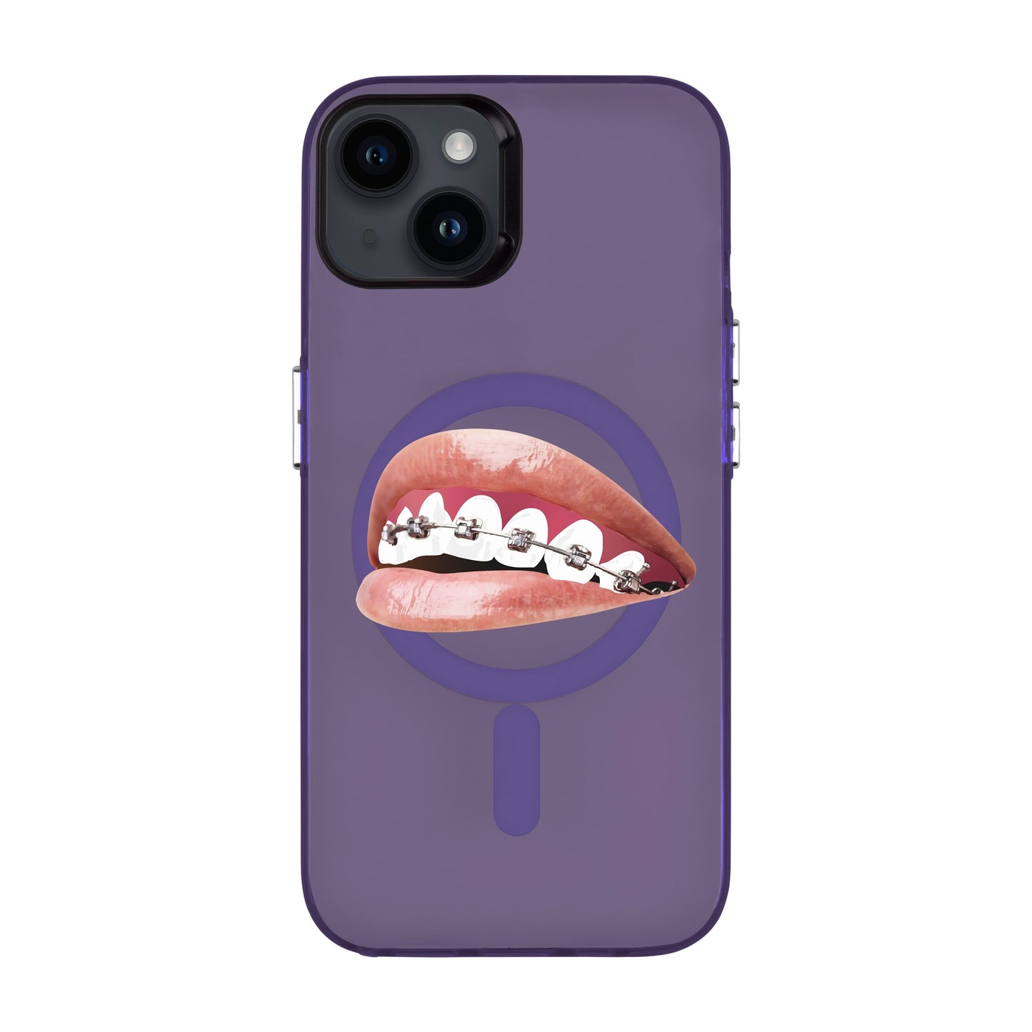 ORTHODONTIST-iPhone 14 Plus Hold Kılıf MagSafe Özellikli