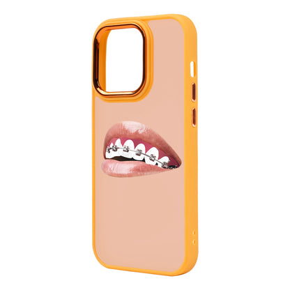 ORTHODONTIST-iPhone 14 Pro Max Proof Kılıf