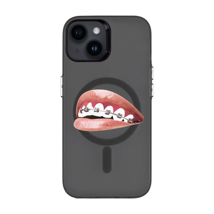 ORTHODONTIST-iPhone 14 Hold Kılıf MagSafe Özellikli