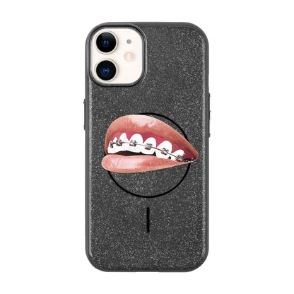 ORTHODONTIST-Radiant Kılıf MagSafe Özellikli - iPhone 11