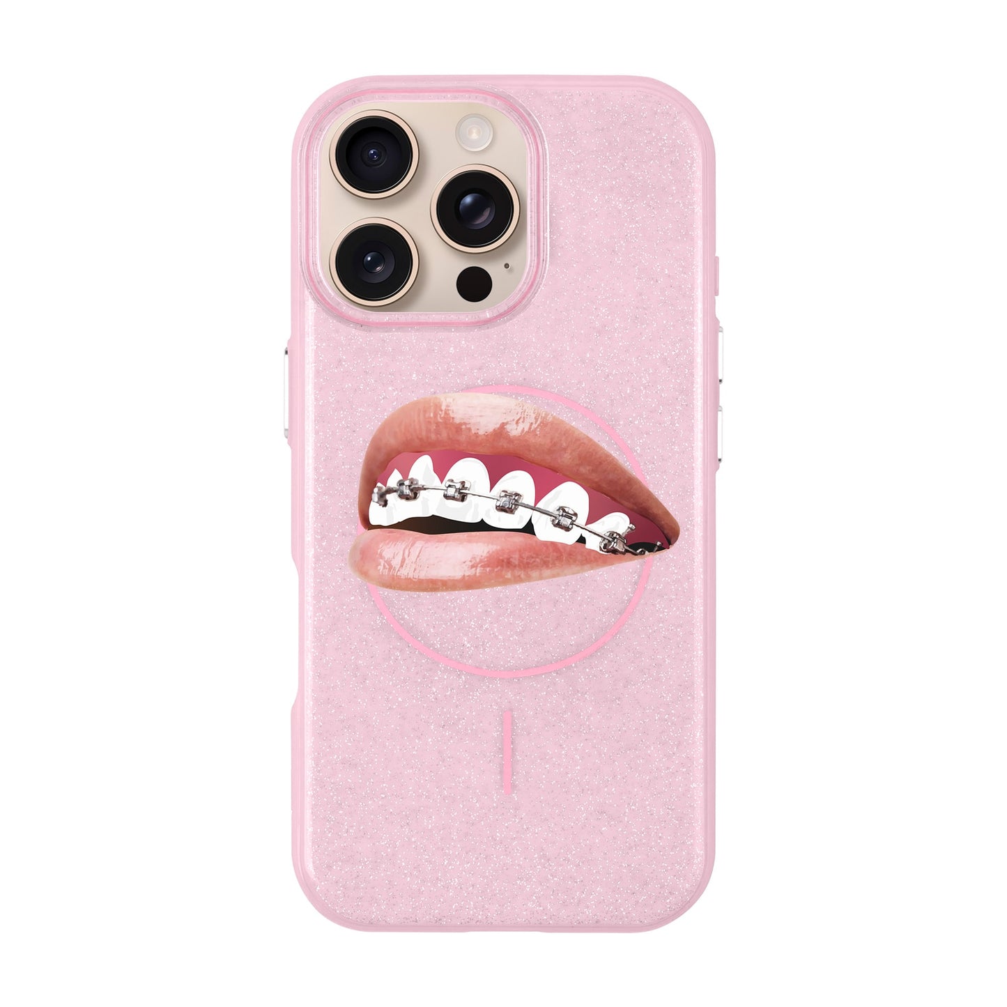 ORTHODONTIST-iPhone 16 Pro Max Radiant Kılıf MagSafe Özellikli