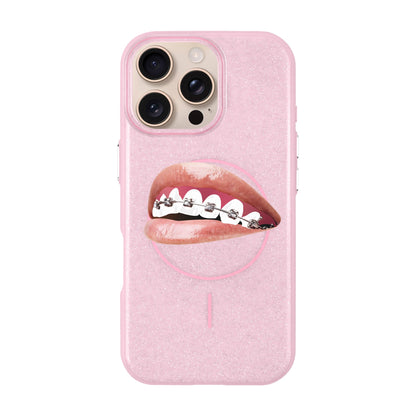 ORTHODONTIST-iPhone 16 Pro Max Radiant Kılıf MagSafe Özellikli
