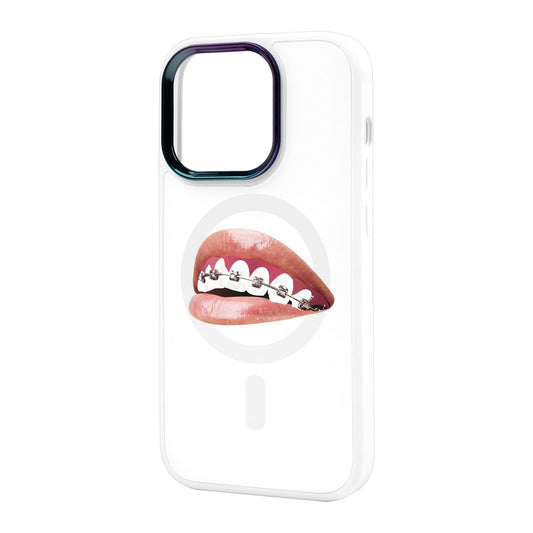 ORTHODONTİST-iPhone 14 Pro Max Vigor Kılıf MagSafe Özellikli