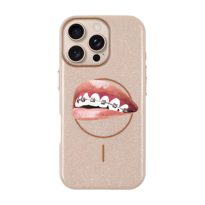 ORTHODONTIST-iPhone 16 Pro Max Radiant Kılıf MagSafe Özellikli