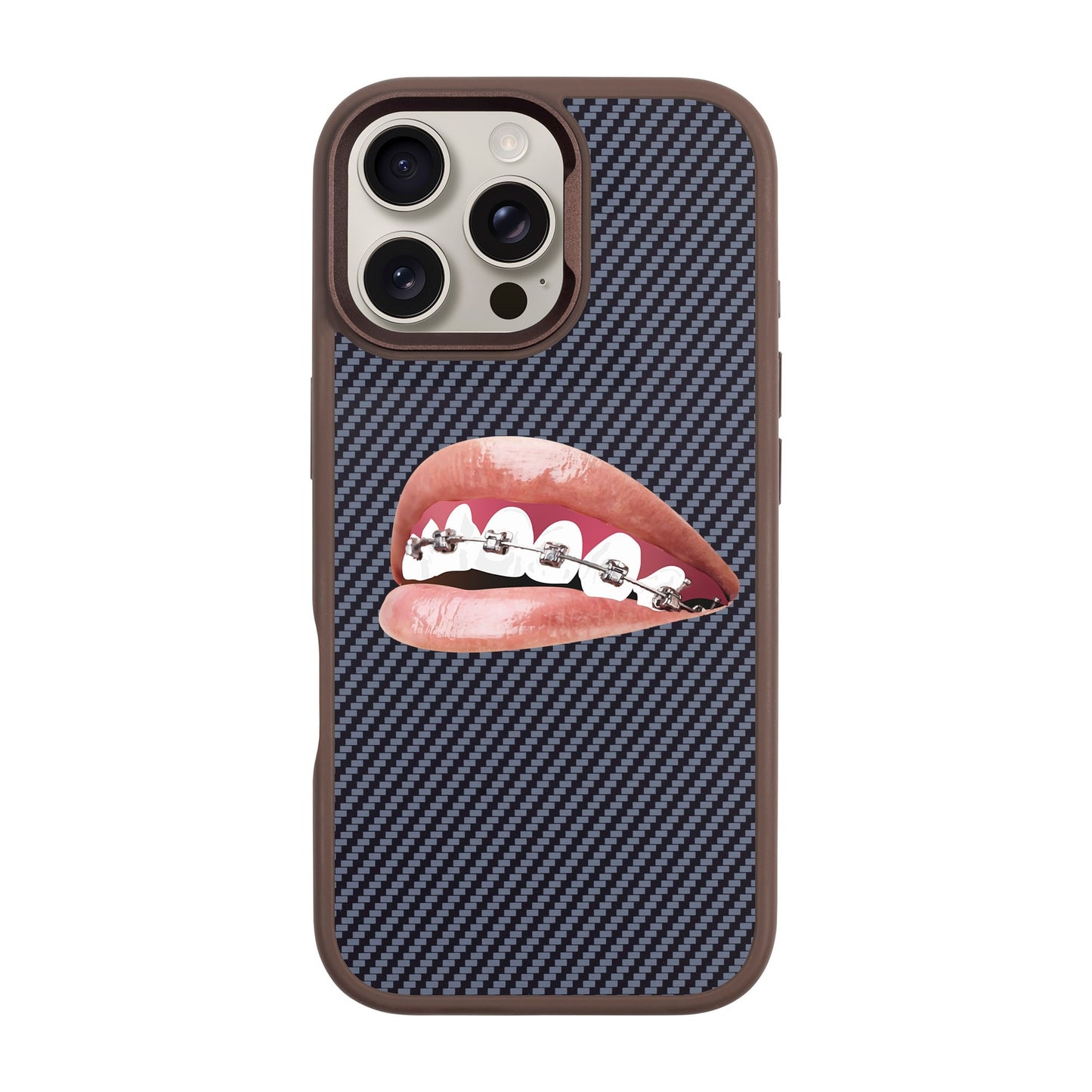 ORTHODONTIST-iPhone 16 Pro Max Plaid Kılıf MagSafe Özellikli