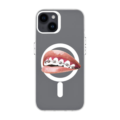 ORTHODONTIST-iPhone 14 Plus Hold Kılıf MagSafe Özellikli