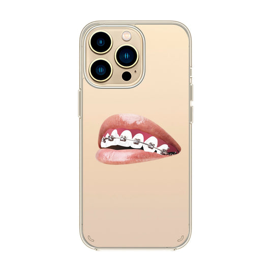 ORTHODONTIST-iPhone 11 Pro Solid Kılıf