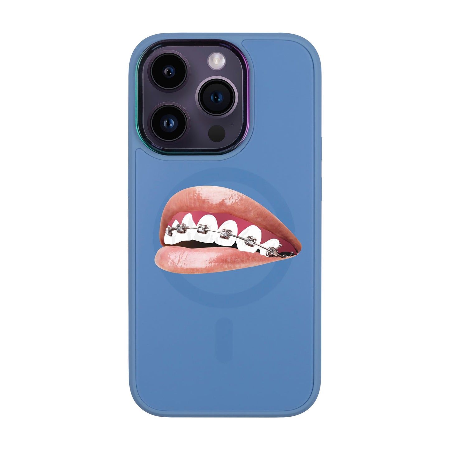 ORTHODONTİST-Vigor Kılıf MagSafe Özellikli - iPhone 14 Pro