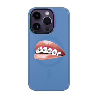 ORTHODONTİST-Vigor Kılıf MagSafe Özellikli - iPhone 14 Pro
