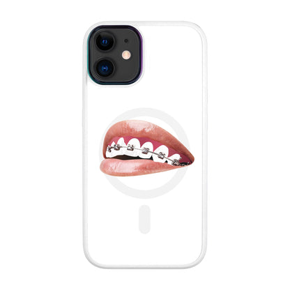 ORTHODONTİST-Vigor Kılıf MagSafe Özellikli - iPhone 11