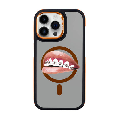 ORTHODONTIST-iPhone 14 Pro Max Dark Kılıf MagSafe Özellikli