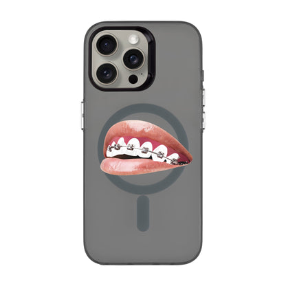 ORTHODONTIST-iPhone 15 Pro Max Hold Kılıf MagSafe Özellikli
