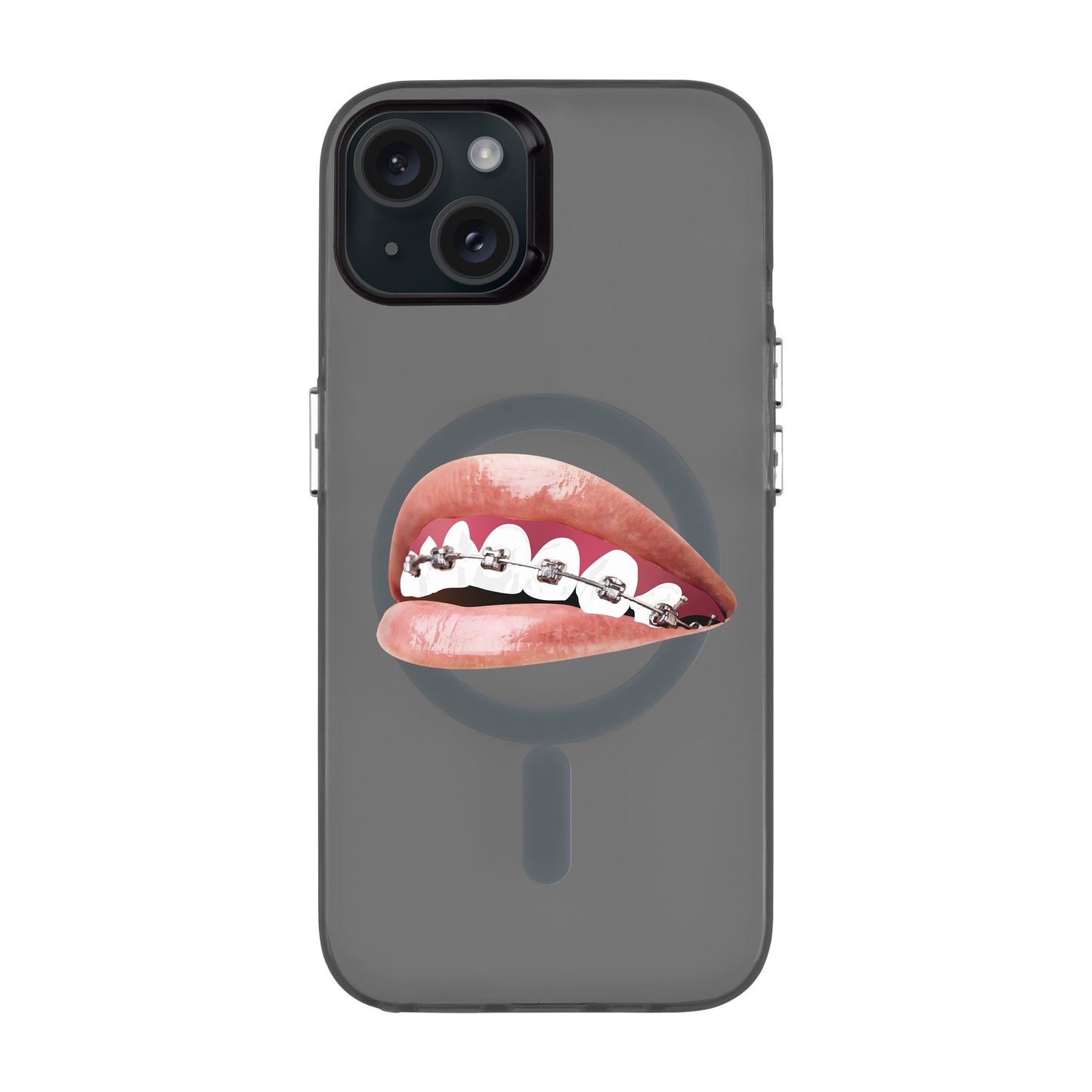 ORTHODONTIST-iPhone 15 Plus Hold Kılıf MagSafe Özellikli
