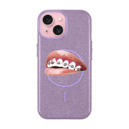 ORTHODONTIST-iPhone 15 Plus Radiant Kılıf MagSafe Özellikli