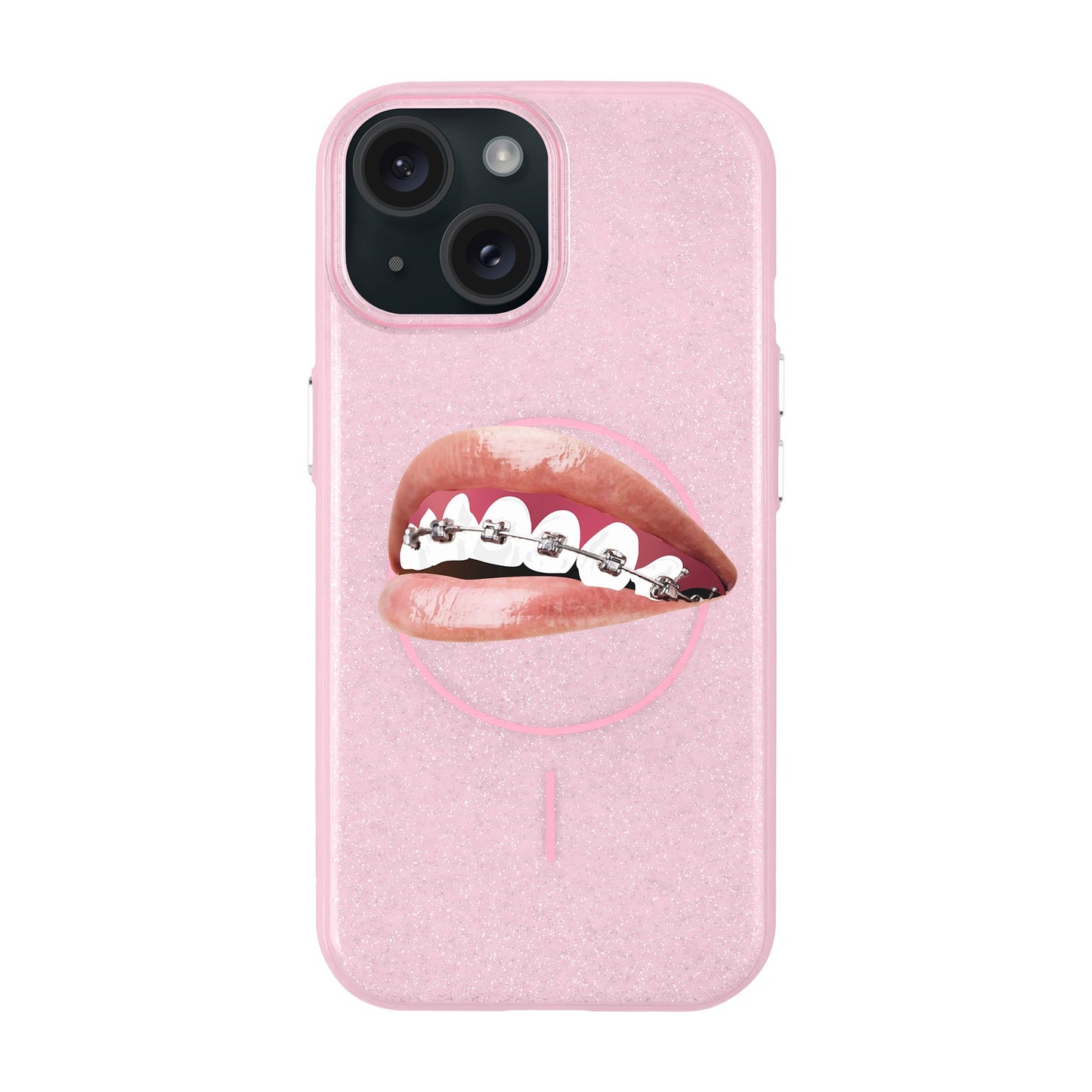 ORTHODONTIST-iPhone 15 Plus Radiant Kılıf MagSafe Özellikli