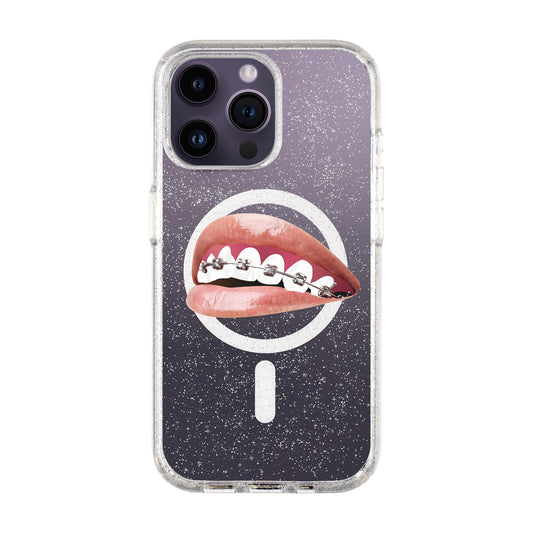 ORTHODONTIST-iPhone 14 Pro Max Shiny Kılıf MagSafe Özellikli