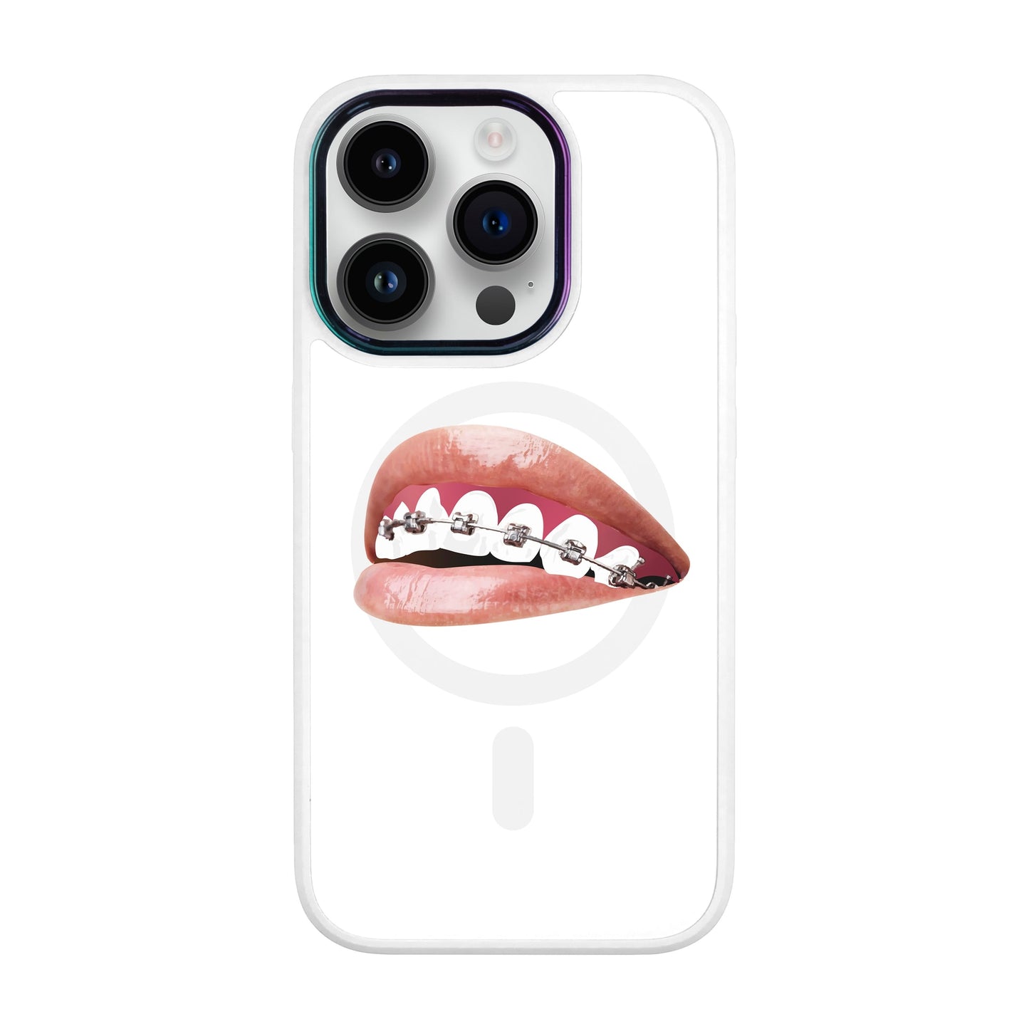 ORTHODONTİST-Vigor Kılıf MagSafe Özellikli - iPhone 14 Pro