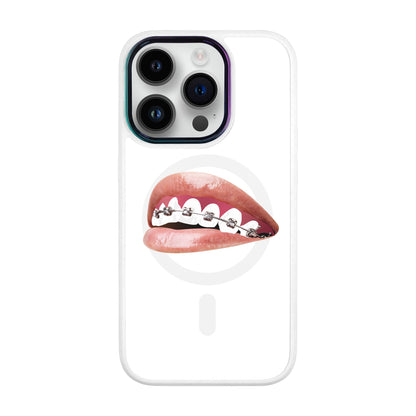 ORTHODONTİST-Vigor Kılıf MagSafe Özellikli - iPhone 14 Pro