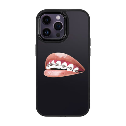 ORTHODONTIST-iPhone 14 Pro Max Proof Kılıf