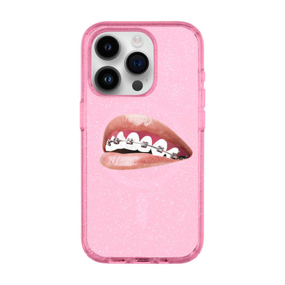 ORTHODONTIST-iPhone 14 Pro Shiny Kılıf MagSafe Özellikli