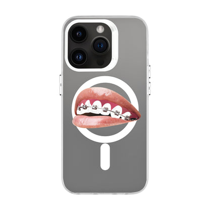 ORTHODONTIST-iPhone 14 Pro Hold Kılıf MagSafe Özellikli