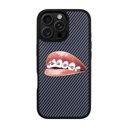 ORTHODONTIST-iPhone 16 Pro Max Plaid Kılıf MagSafe Özellikli