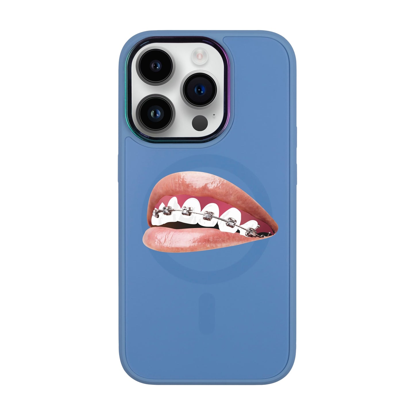 ORTHODONTİST-Vigor Kılıf MagSafe Özellikli - iPhone 14 Pro