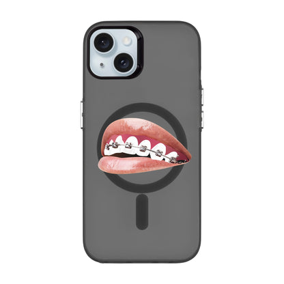 ORTHODONTIST-iPhone 15 Plus Hold Kılıf MagSafe Özellikli