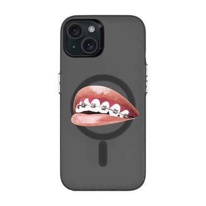 ORTHODONTIST-iPhone 15 Plus Hold Kılıf MagSafe Özellikli