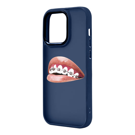 ORTHODONTIST-iPhone 14 Pro Max Proof Kılıf