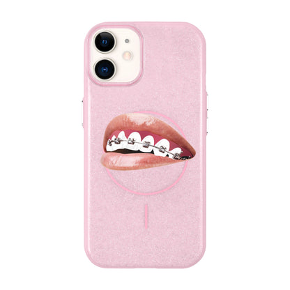 ORTHODONTIST-Radiant Kılıf MagSafe Özellikli - iPhone 11