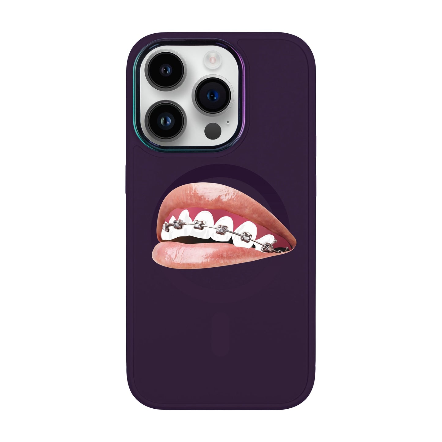 ORTHODONTİST-Vigor Kılıf MagSafe Özellikli - iPhone 14 Pro