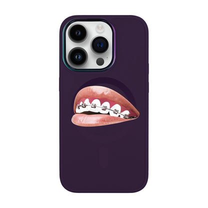 ORTHODONTİST-Vigor Kılıf MagSafe Özellikli - iPhone 14 Pro