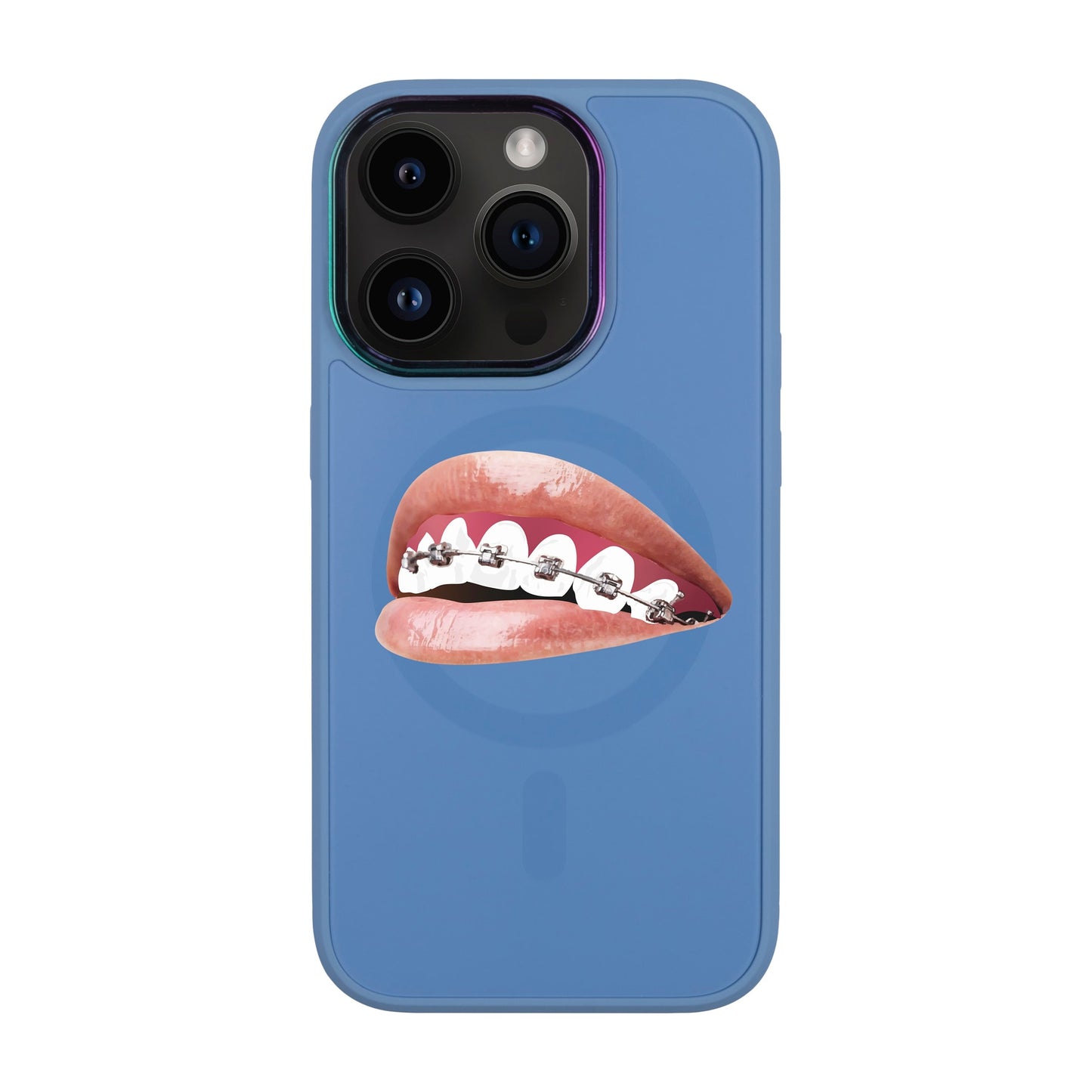 ORTHODONTİST-Vigor Kılıf MagSafe Özellikli - iPhone 14 Pro