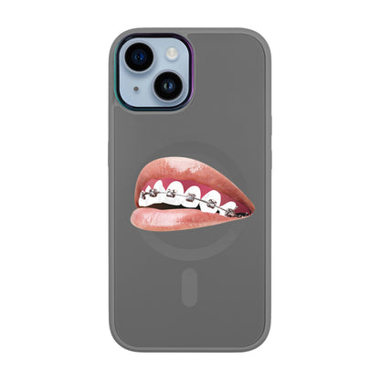 ORTHODONTİST-iPhone 12 Vigor Kılıf MagSafe Özellikli