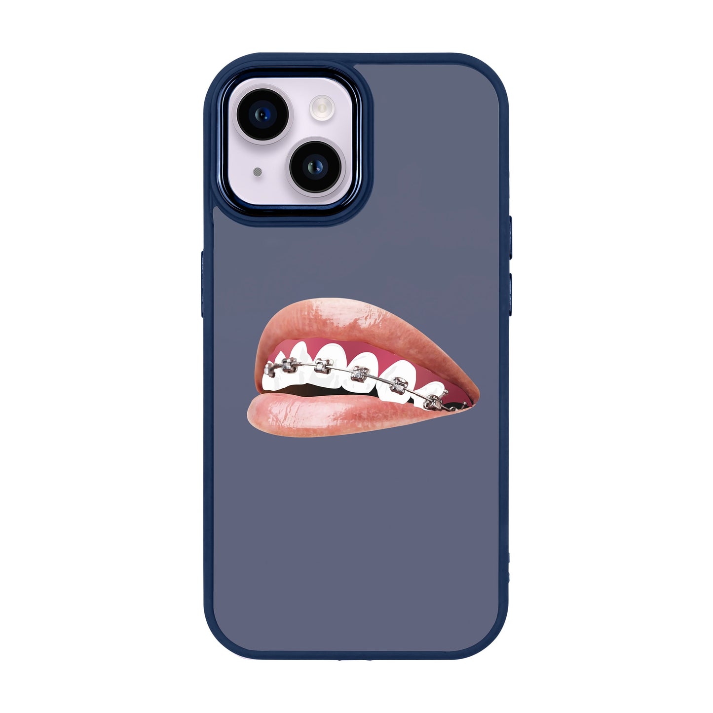 ORTHODONTIST-Proof Kılıf - iPhone 14