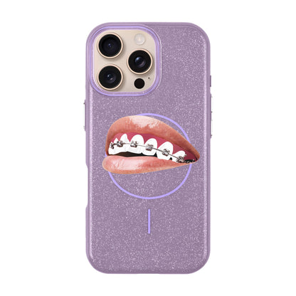 ORTHODONTIST-iPhone 16 Pro Max Radiant Kılıf MagSafe Özellikli