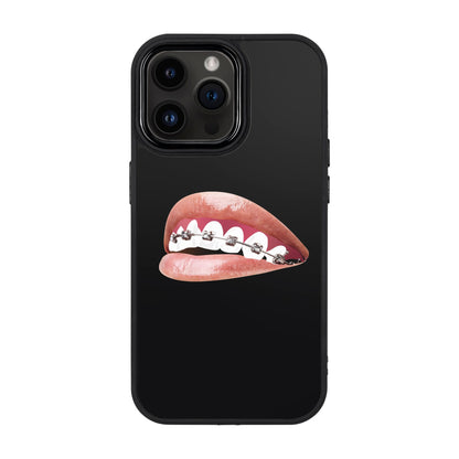 ORTHODONTIST-iPhone 14 Pro Max Proof Kılıf