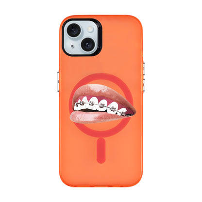 ORTHODONTIST-iPhone 15 Plus Hold Kılıf MagSafe Özellikli