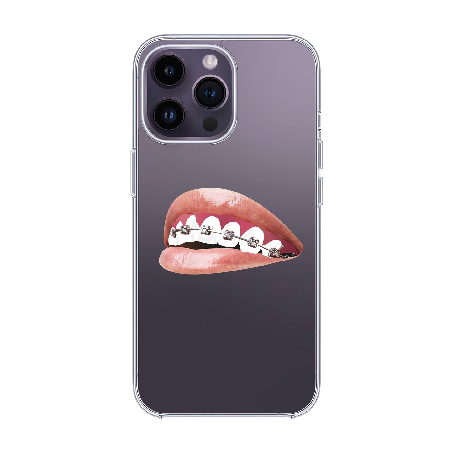 ORTHODONTIST-iPhone 14 Pro Max Solid Kılıf