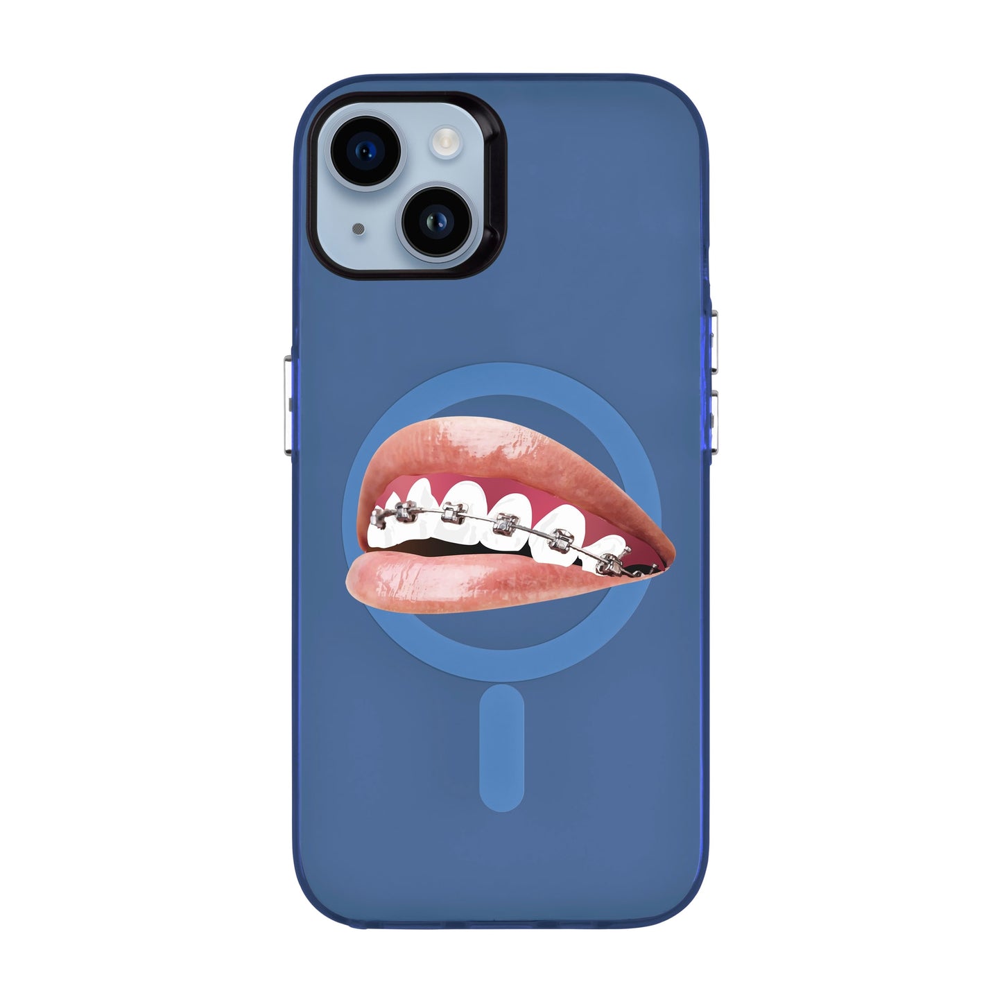 ORTHODONTIST-iPhone 14 Plus Hold Kılıf MagSafe Özellikli