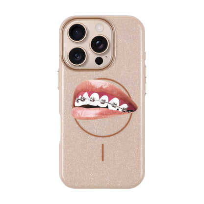 ORTHODONTIST-iPhone 16 Pro Radiant Kılıf MagSafe Özellikli