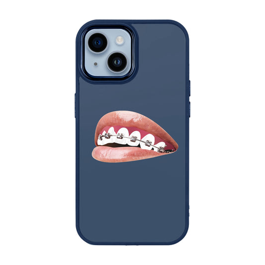 ORTHODONTIST-Proof Kılıf - iPhone 14