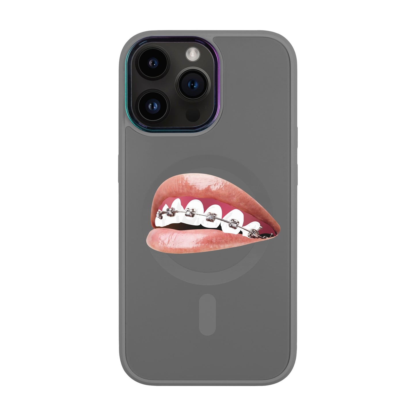 ORTHODONTİST-iPhone 13 Pro Max Vigor Kılıf MagSafe Özellikli