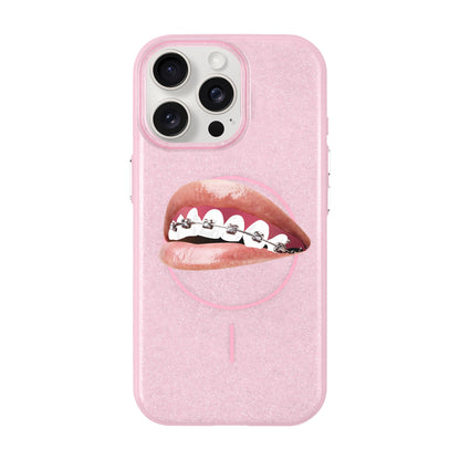 ORTHODONTIST-iPhone 15 Pro Max Radiant Kılıf MagSafe Özellikli