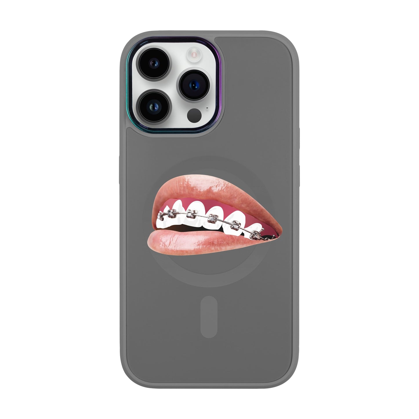 ORTHODONTİST-iPhone 14 Pro Max Vigor Kılıf MagSafe Özellikli