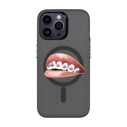 ORTHODONTIST-iPhone 14 Pro Max Hold Kılıf MagSafe Özellikli