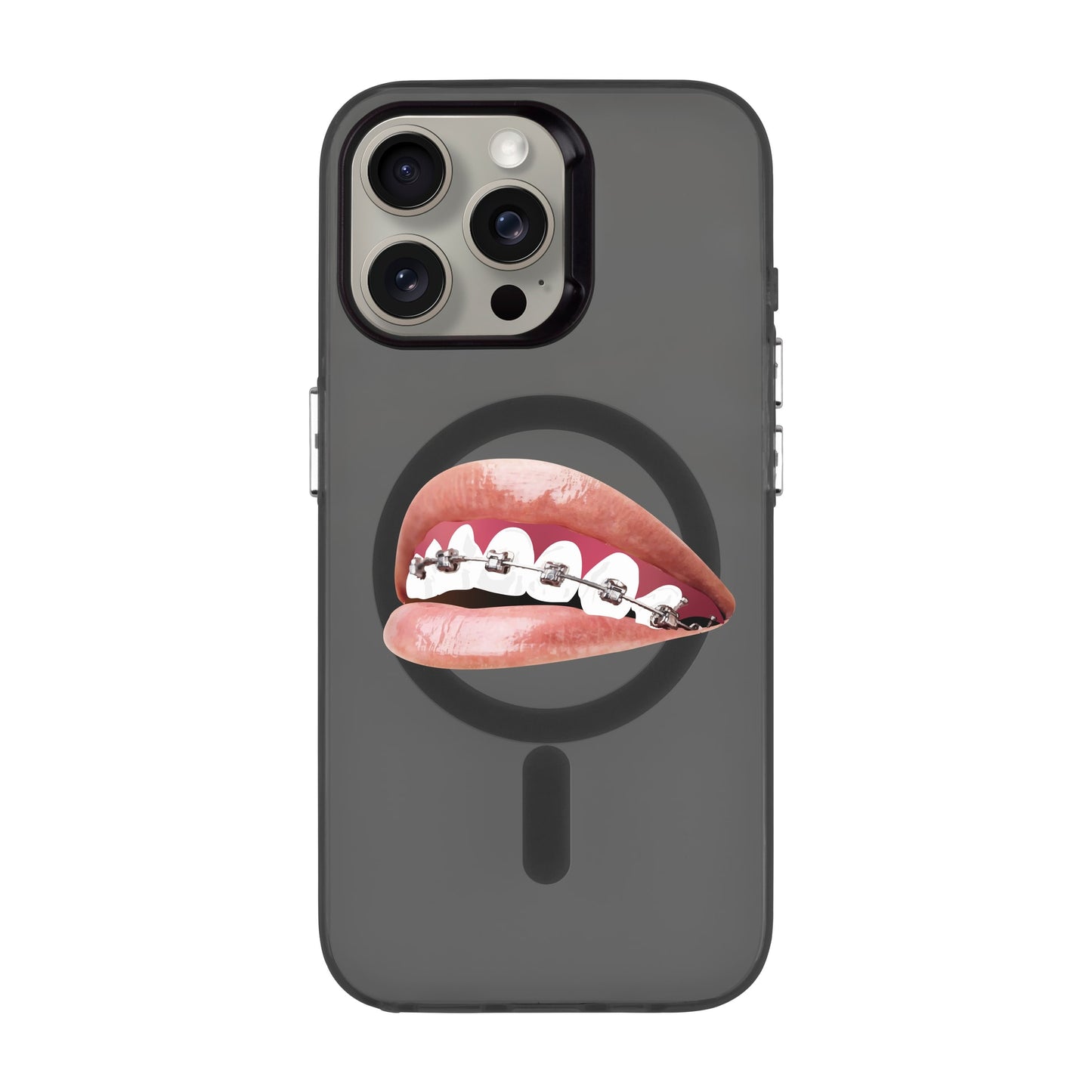 ORTHODONTIST-iPhone 15 Pro Max Hold Kılıf MagSafe Özellikli